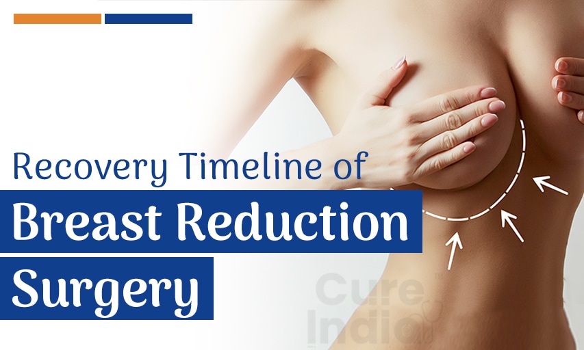 How much is breast reduction recovery time and how to speed it up?
